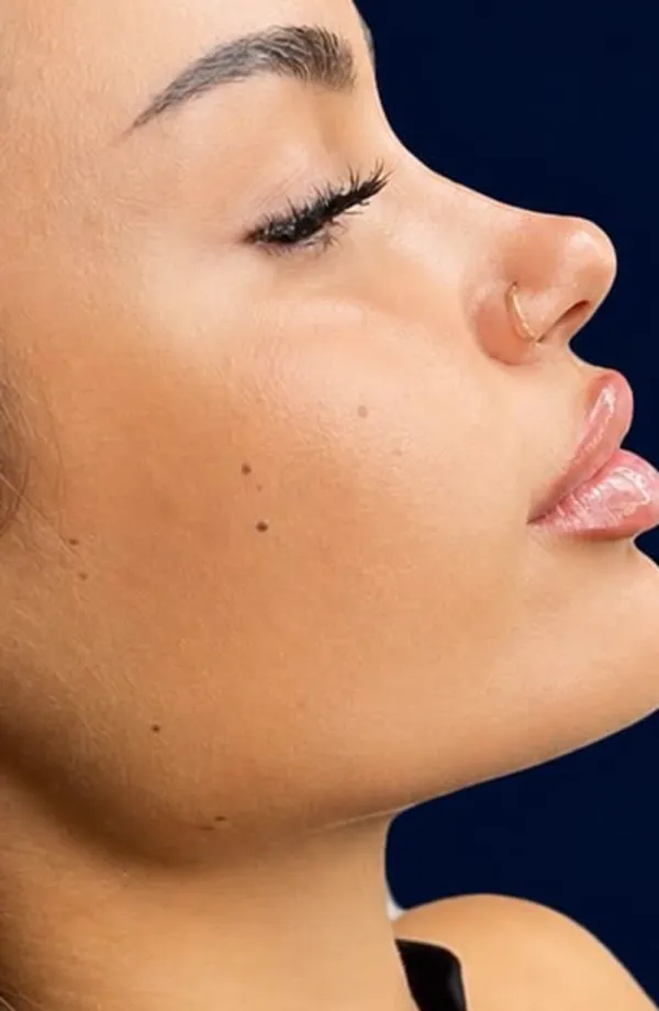 A woman’s profile against a navy backdrop